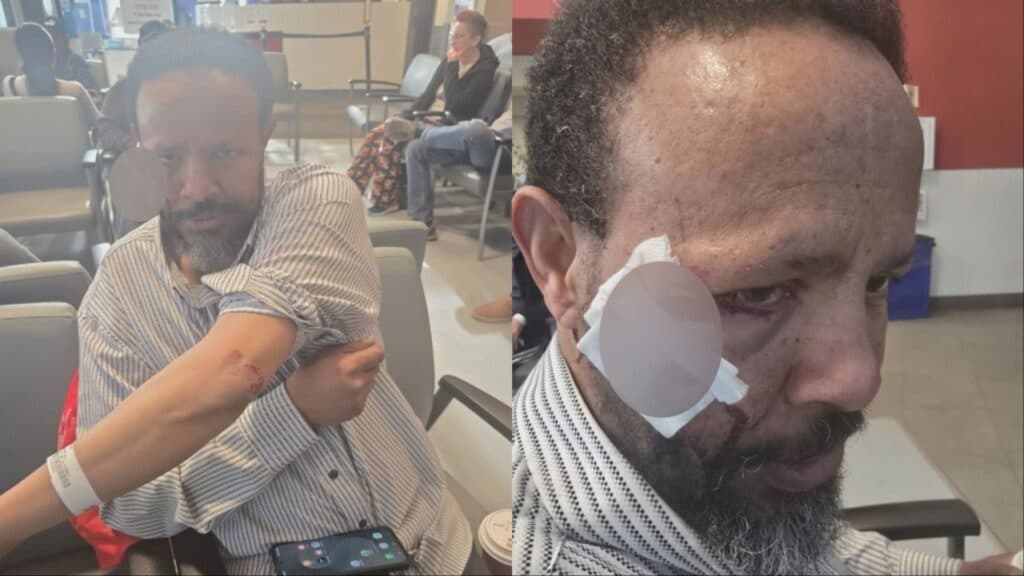 Edmonton Man Charged With Aggravated Assault After Attack on Muslim Man
