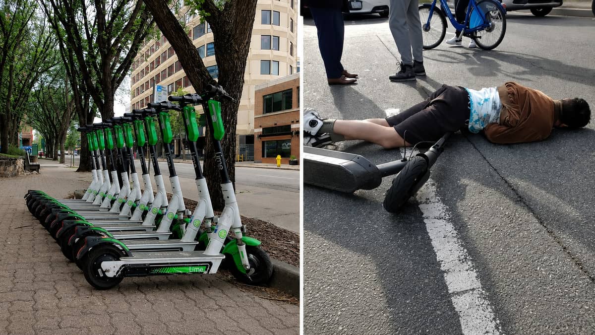 E-Scooter Injuries Are Surging Across Alberta, and Edmonton Now Leads the Province With 1,198 ER Visits in One Year
