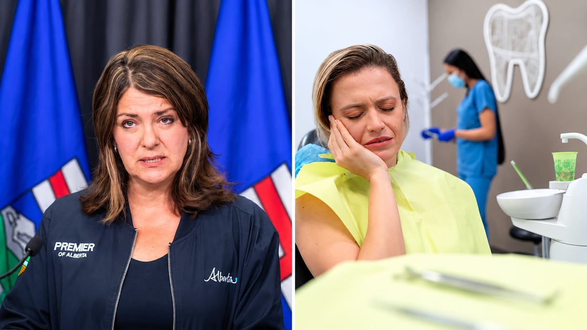 Alberta Still Wants Out of Federal Dental Care Plan After 57.6% Vote No, Leaving 349,000 Enrolled Albertans Waiting